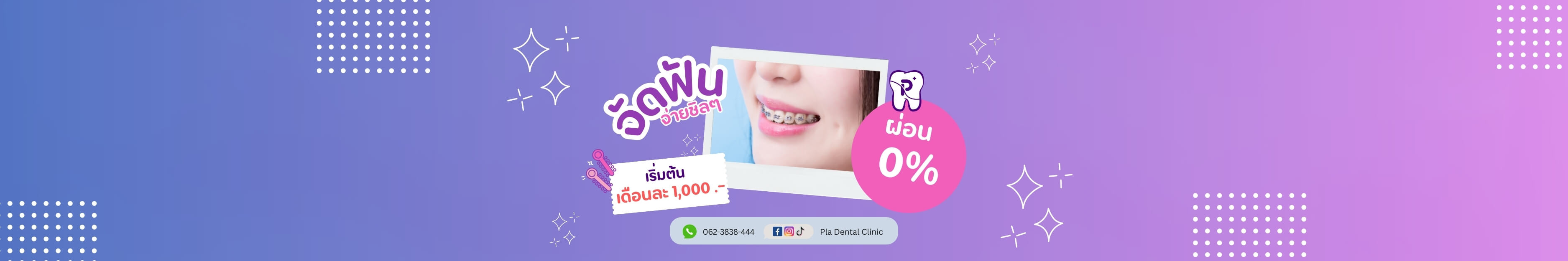 จัดฟันกับคลินิกหมอปลา เพียงเดือนละ 1000 บาท พร้อมของแถมเพียบ