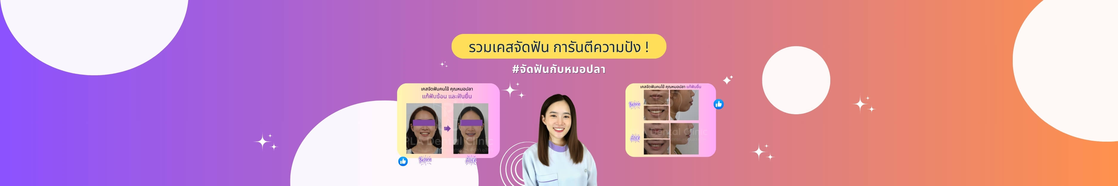 รวมรีวิวเคส จัดฟัน ทำฟัน ของคลินิกทันตกรรมหมอปลา