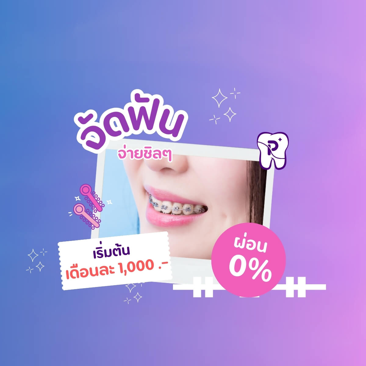 จัดฟันกับคลินิกหมอปลา เพียงเดือนละ 1000 บาท พร้อมของแถมเพียบ