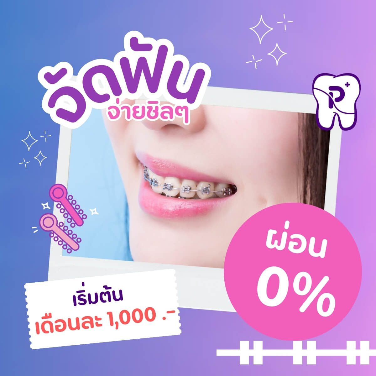 โปรจัดฟันแบบสบายกระเป๋า ผ่อน 0% เริ่ม 1000 บาทต่อเดือน